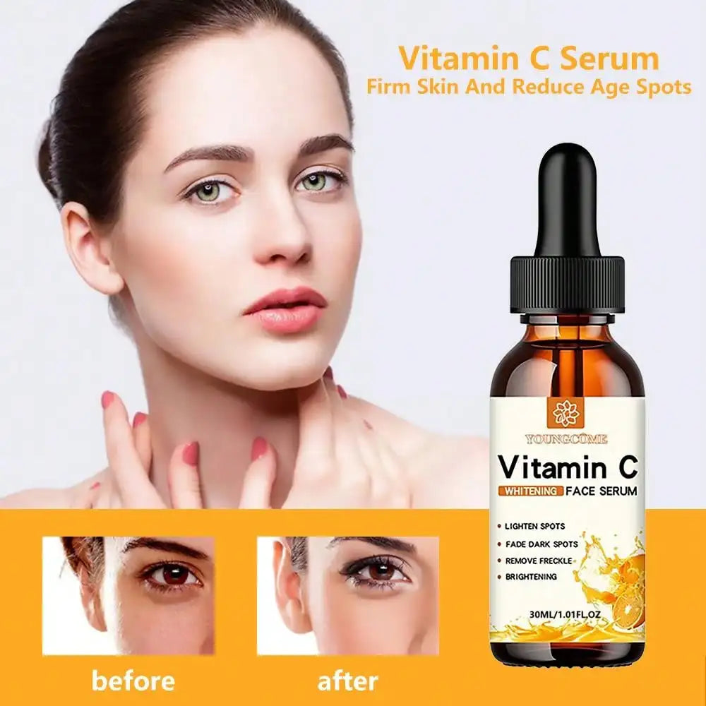 VitaC Essence – Dark Spot Remover & Anti-Aging Facial Serum (30ml)