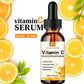 VitaC Essence – Dark Spot Remover & Anti-Aging Facial Serum (30ml)